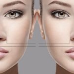 آنزیم بینی برای کوچک کردن